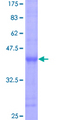 BCL7C Protein - 12.5% SDS-PAGE Stained with Coomassie Blue.