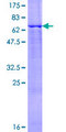 BCS1L Protein - 12.5% SDS-PAGE of human BCS1L stained with Coomassie Blue