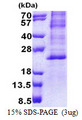 BHLHB40 / HES2 Protein