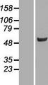 BIVM Protein - Western validation with an anti-DDK antibody * L: Control HEK293 lysate R: Over-expression lysate