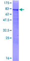 BLAP75 / RMI1 Protein - 12.5% SDS-PAGE of human RMI1 stained with Coomassie Blue