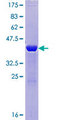 BLOC1S2 Protein - 12.5% SDS-PAGE of human BLOC1S2 stained with Coomassie Blue