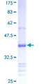 BMP3 Protein - 12.5% SDS-PAGE Stained with Coomassie Blue.