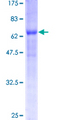 BNIP2 Protein - 12.5% SDS-PAGE of human BNIP2 stained with Coomassie Blue