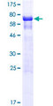 BOD1L1 / BOD1L Protein - 12.5% SDS-PAGE of human FAM44A stained with Coomassie Blue