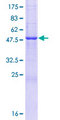 BPIFA3 / SPLUNC3 Protein - 12.5% SDS-PAGE of human C20orf71 stained with Coomassie Blue