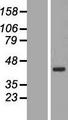 BRIX1 Protein - Western validation with an anti-DDK antibody * L: Control HEK293 lysate R: Over-expression lysate