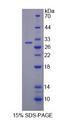 BTD / Biotinidase Protein - Recombinant  Biotinidase By SDS-PAGE