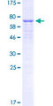 C/EBP Alpha / CEBPA Protein - 12.5% SDS-PAGE of human CEBPA stained with Coomassie Blue