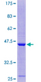 C11orf1 Protein - 12.5% SDS-PAGE of human C11orf1 stained with Coomassie Blue