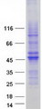 C11orf42 Protein - Purified recombinant protein C11orf42 was analyzed by SDS-PAGE gel and Coomassie Blue Staining