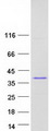 C11orf58 Protein - Purified recombinant protein C11orf58 was analyzed by SDS-PAGE gel and Coomassie Blue Staining