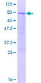 C12orf40 Protein - 12.5% SDS-PAGE of human C12orf40 stained with Coomassie Blue