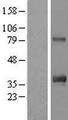 C12orf43 Protein - Western validation with an anti-DDK antibody * L: Control HEK293 lysate R: Over-expression lysate