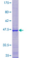 C12orf65 Protein - 12.5% SDS-PAGE of human FLJ38663 stained with Coomassie Blue