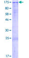 C13orf8 / ZNF828 Protein - 12.5% SDS-PAGE of human C13orf8 stained with Coomassie Blue