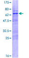 C14orf106 Protein - 12.5% SDS-PAGE of human C14orf106 stained with Coomassie Blue