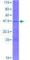 C14orf159 Protein - 12.5% SDS-PAGE of human C14orf159 stained with Coomassie Blue