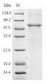C14orf166 Protein - (Tris-Glycine gel) Discontinuous SDS-PAGE (reduced) with 5% enrichment gel and 15% separation gel.