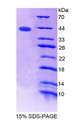 C15orf48 / NMES1 Protein - Recombinant Normal Mucosa Of Esophagus Specific 1 By SDS-PAGE