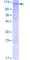 C16orf62 Protein - 12.5% SDS-PAGE of human C16orf62 stained with Coomassie Blue