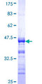 C17orf75 Protein - 12.5% SDS-PAGE Stained with Coomassie Blue.
