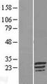 C17orf82 Protein - Western validation with an anti-DDK antibody * L: Control HEK293 lysate R: Over-expression lysate