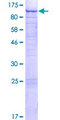 C1orf112 Protein - 12.5% SDS-PAGE of human C1orf112 stained with Coomassie Blue