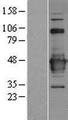 C22orf29 Protein - Western validation with an anti-DDK antibody * L: Control HEK293 lysate R: Over-expression lysate