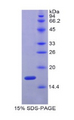 C25H / CH25H Protein - Recombinant Cholesterol-25-Hydroxylase (CH25H) by SDS-PAGE