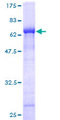 C2CD2 Protein - 12.5% SDS-PAGE of human C21orf25 stained with Coomassie Blue