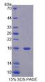 C2orf40 / ECRG4 Protein - Recombinant Esophageal Cancer Related Gene 4 By SDS-PAGE
