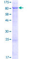 C2orf63 Protein - 12.5% SDS-PAGE of human C2orf63 stained with Coomassie Blue