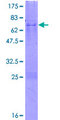 C3orf38 Protein - 12.5% SDS-PAGE of human C3orf38 stained with Coomassie Blue