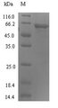 C4orf29 Protein - (Tris-Glycine gel) Discontinuous SDS-PAGE (reduced) with 5% enrichment gel and 15% separation gel.