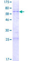 C6orf81 Protein - 12.5% SDS-PAGE of human C6orf81 stained with Coomassie Blue