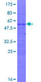 C9orf152 Protein - 12.5% SDS-PAGE of human C9orf152 stained with Coomassie Blue