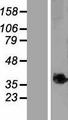 C9orf91 Protein - Western validation with an anti-DDK antibody * L: Control HEK293 lysate R: Over-expression lysate