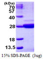 C9orf95 / NRK1 Protein