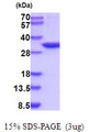 CA13 / Carbonic Anhydrase XIII Protein