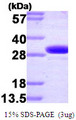 CA2 / Carbonic Anhydrase II Protein