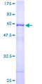 CA4 / Carbonic Anhydrase IV Protein - 12.5% SDS-PAGE of human CA4 stained with Coomassie Blue