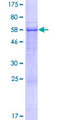 CACUL1 / Cullin Protein - 12.5% SDS-PAGE of human C10orf46 stained with Coomassie Blue