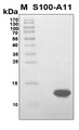 Calgizzarin / S100A11 Protein