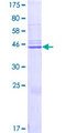 CAPSL Protein - 12.5% SDS-PAGE of human CAPSL stained with Coomassie Blue