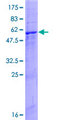 CAPZA3 Protein - 12.5% SDS-PAGE of human CAPZA3 stained with Coomassie Blue