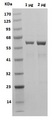 CAT / Catalase Protein - Catalase, Human Recombinant