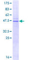 CAV1 / Caveolin 1 Protein - 12.5% SDS-PAGE of human CAV1 stained with Coomassie Blue