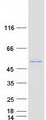 CBWD3 Protein - Purified recombinant protein CBWD3 was analyzed by SDS-PAGE gel and Coomassie Blue Staining
