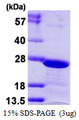 CBX3 / HP1 Gamma Protein